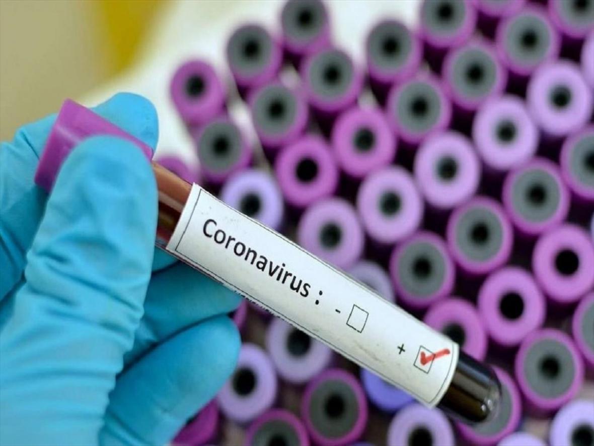 نخستین مورد مبتلا به ویروس کرونا در مصر ثبت شد